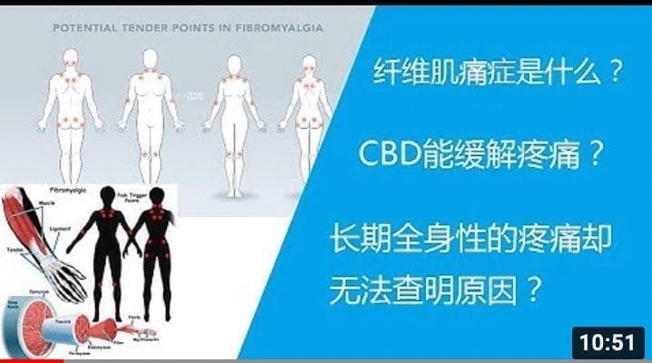 长期全身疼痛却无法查明原因？风湿类疼痛？或许是 纤维肌痛证症！ CBD或许能帮您缓解症状